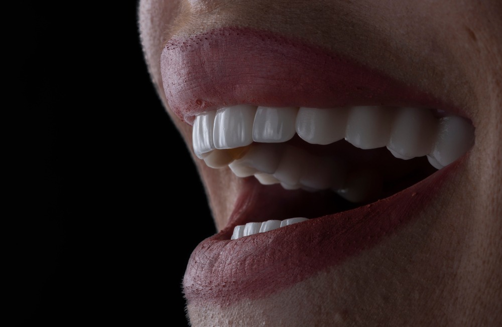 The Top Foods To Avoid With Veneers